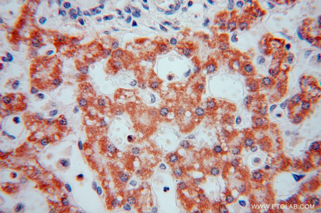 PAN2 Antibody in Immunohistochemistry (Paraffin) (IHC (P))