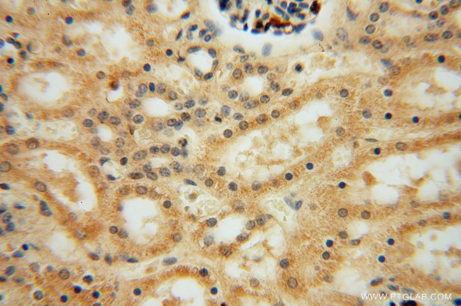 PAN2 Antibody in Immunohistochemistry (Paraffin) (IHC (P))