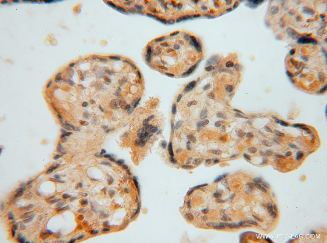 PAN2 Antibody in Immunohistochemistry (Paraffin) (IHC (P))