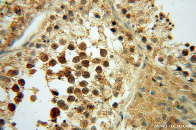 PAN2 Antibody in Immunohistochemistry (Paraffin) (IHC (P))