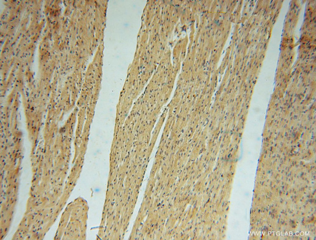 PAN2 Antibody in Immunohistochemistry (Paraffin) (IHC (P))