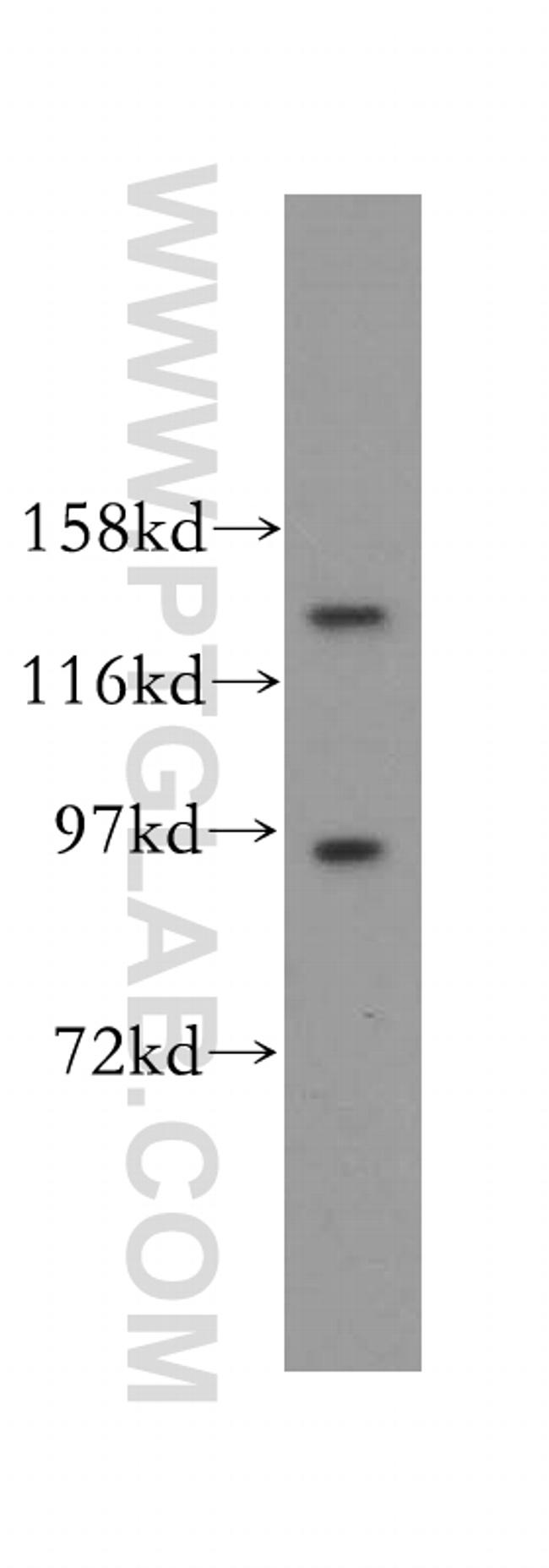 PAN2 Antibody in Western Blot (WB)