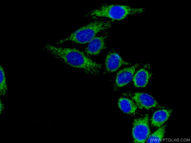 DLD Antibody in Immunocytochemistry (ICC/IF)