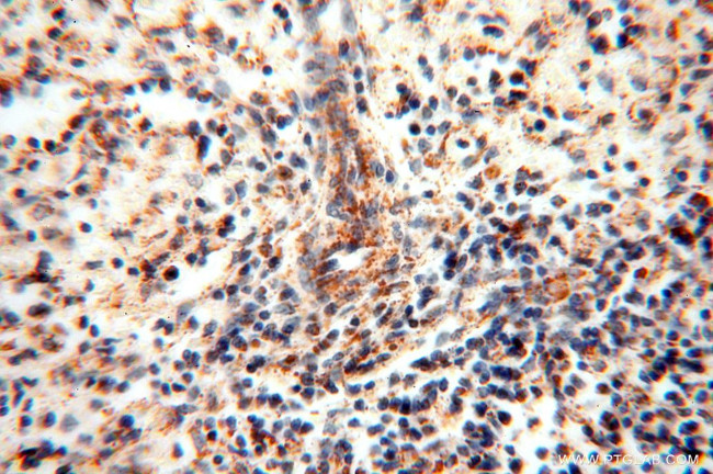 DLD Antibody in Immunohistochemistry (Paraffin) (IHC (P))