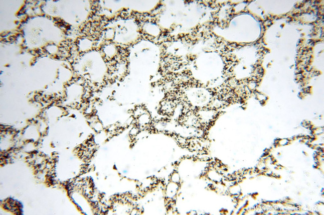 DLD Antibody in Immunohistochemistry (Paraffin) (IHC (P))