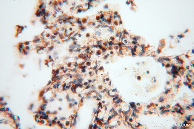 DLD Antibody in Immunohistochemistry (Paraffin) (IHC (P))