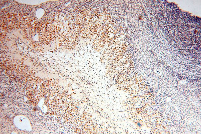 DLD Antibody in Immunohistochemistry (Paraffin) (IHC (P))