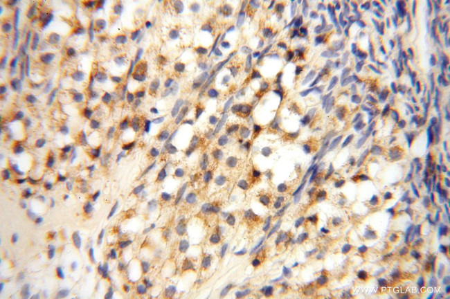 DLD Antibody in Immunohistochemistry (Paraffin) (IHC (P))