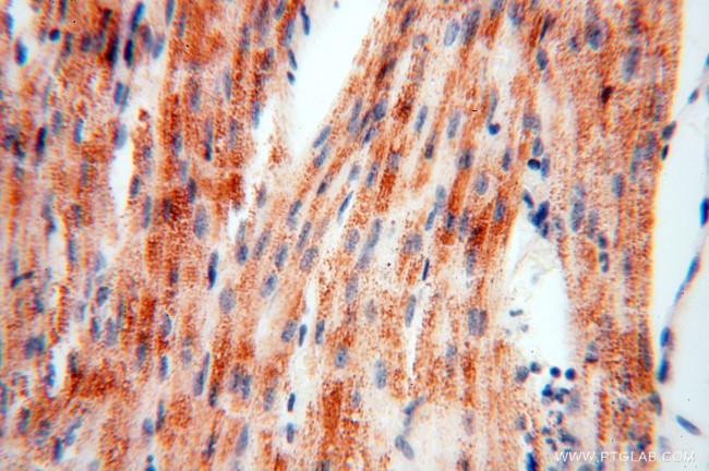 DLD Antibody in Immunohistochemistry (Paraffin) (IHC (P))