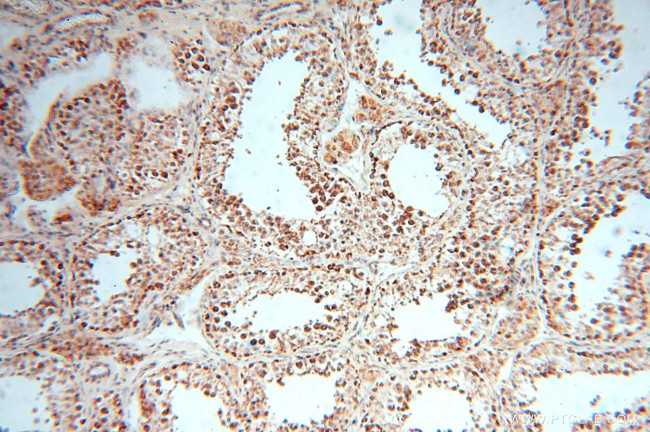 DLD Antibody in Immunohistochemistry (Paraffin) (IHC (P))