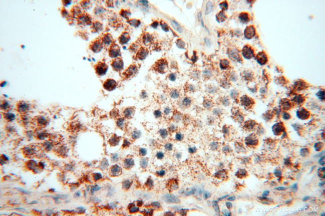 DLD Antibody in Immunohistochemistry (Paraffin) (IHC (P))