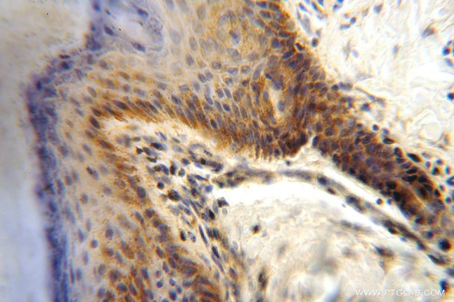 DLD Antibody in Immunohistochemistry (Paraffin) (IHC (P))