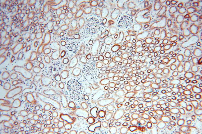 DLD Antibody in Immunohistochemistry (Paraffin) (IHC (P))