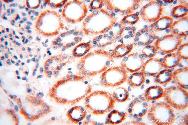 DLD Antibody in Immunohistochemistry (Paraffin) (IHC (P))