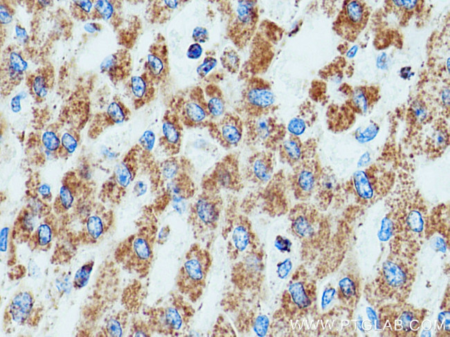 DLD Antibody in Immunohistochemistry (Paraffin) (IHC (P))