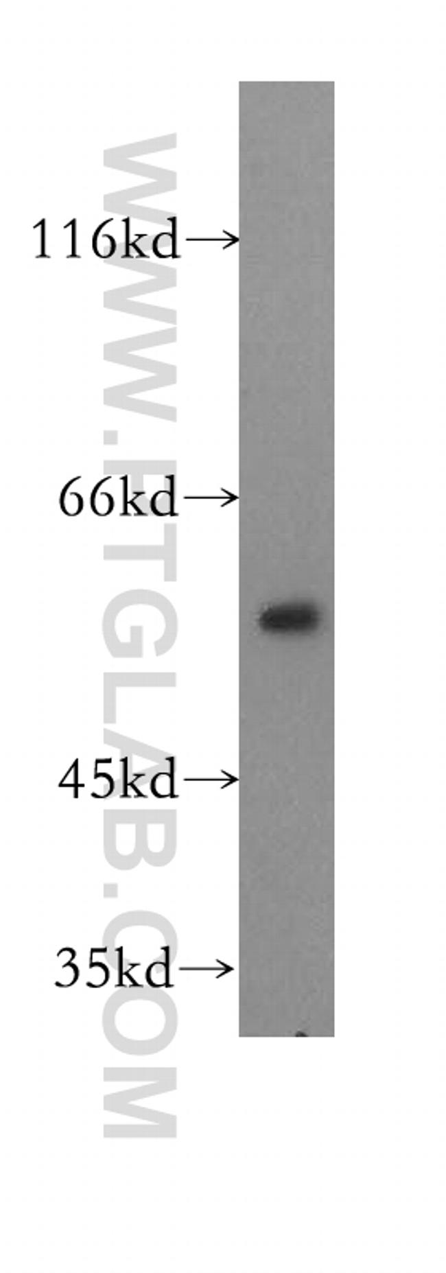 DLD Antibody in Western Blot (WB)