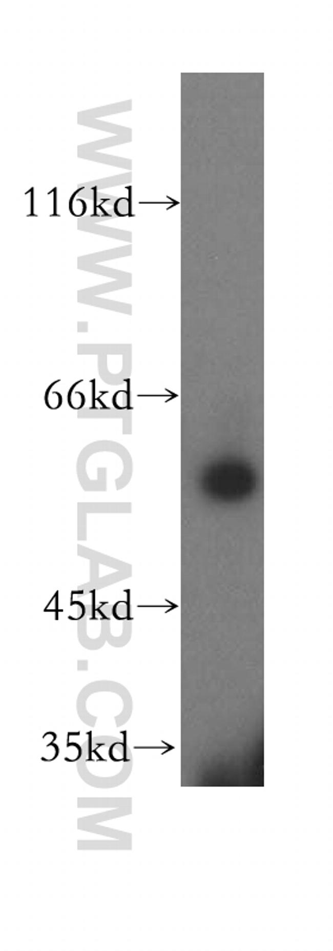 DLD Antibody in Western Blot (WB)