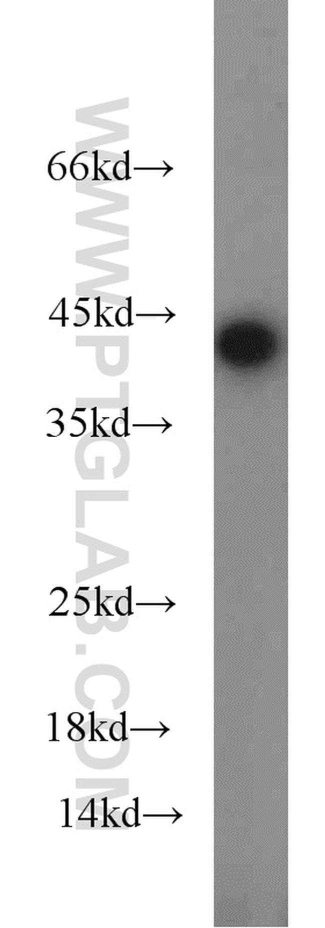 ORM1 Antibody in Western Blot (WB)