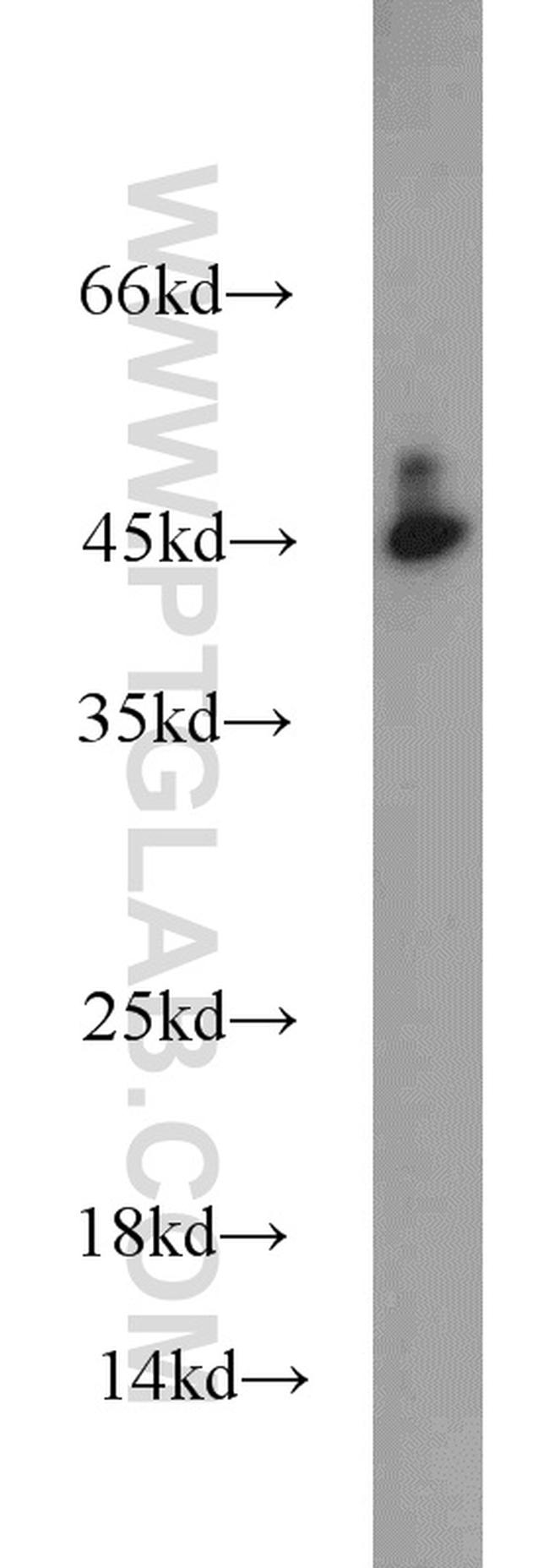 ORM1 Antibody in Western Blot (WB)