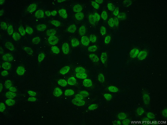 Histone H2A.z Antibody in Immunocytochemistry (ICC/IF)