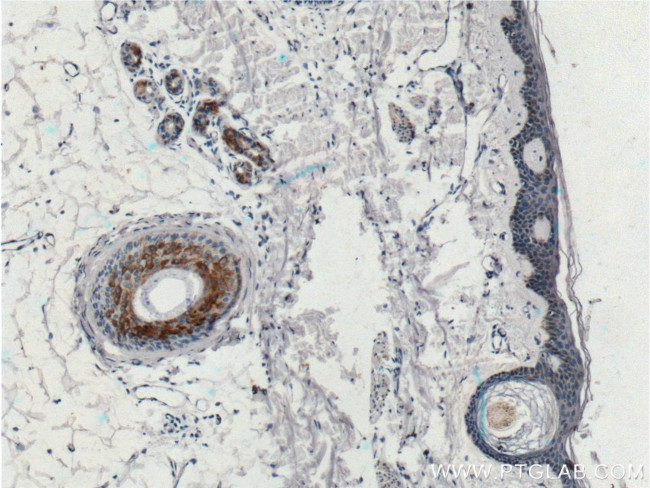 ST6GALNAC5 Antibody in Immunohistochemistry (Paraffin) (IHC (P))