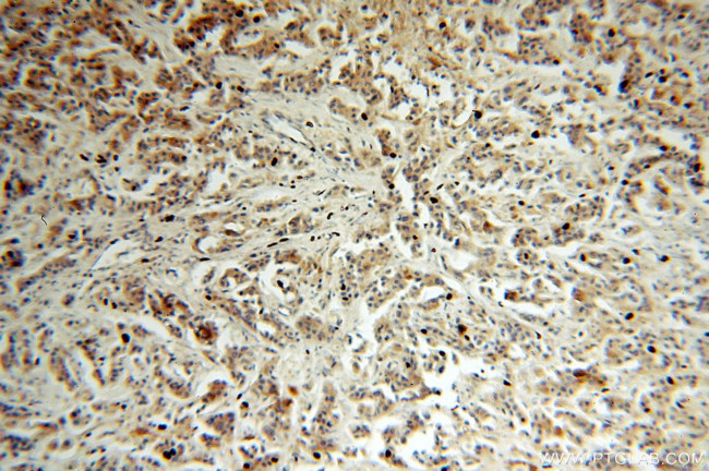 ST6GALNAC5 Antibody in Immunohistochemistry (Paraffin) (IHC (P))