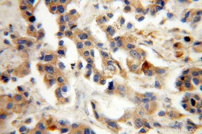 ST6GALNAC5 Antibody in Immunohistochemistry (Paraffin) (IHC (P))