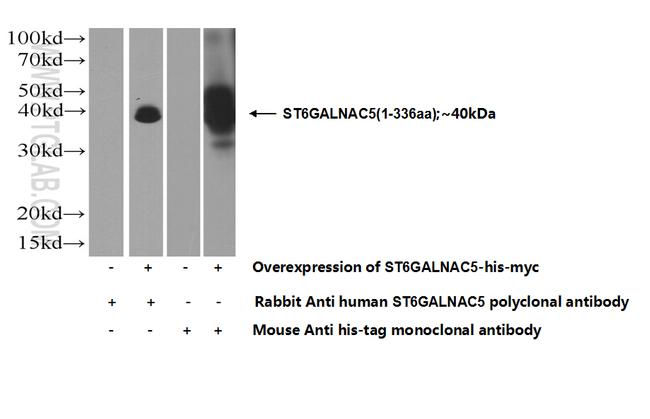 ST6GALNAC5 Antibody in Western Blot (WB)