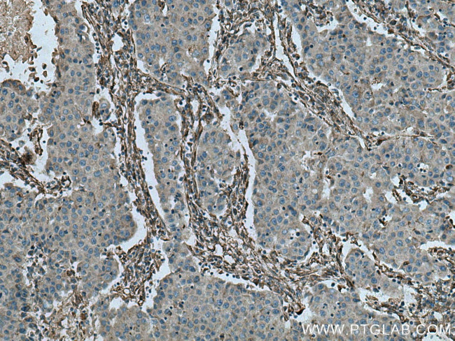 Caveolin-1 Antibody in Immunohistochemistry (Paraffin) (IHC (P))