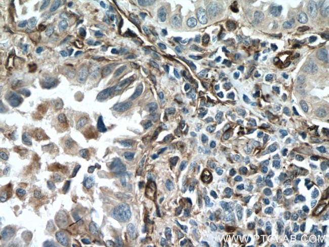 Caveolin-1 Antibody in Immunohistochemistry (Paraffin) (IHC (P))