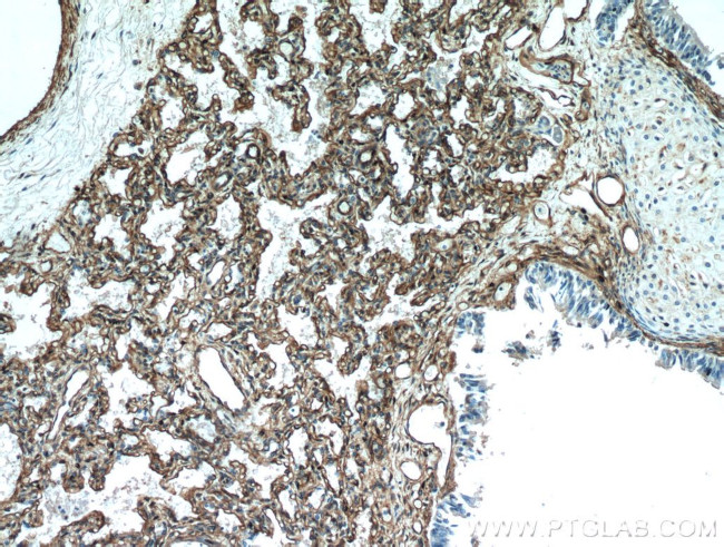 Caveolin-1 Antibody in Immunohistochemistry (Paraffin) (IHC (P))