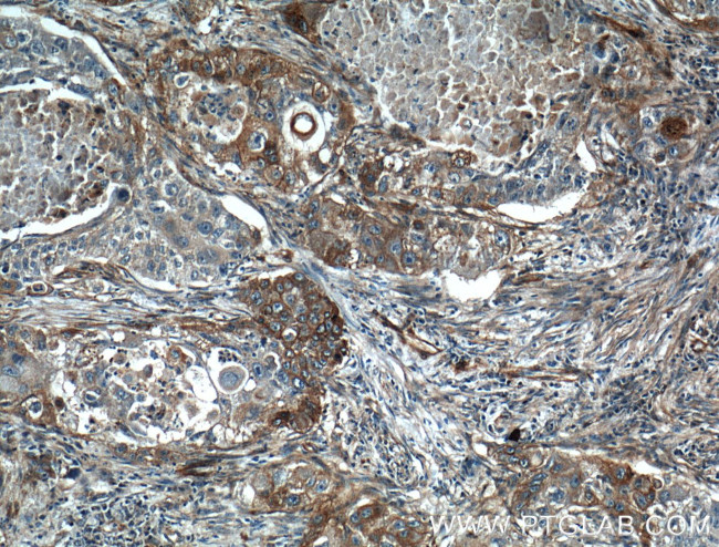 Caveolin-1 Antibody in Immunohistochemistry (Paraffin) (IHC (P))