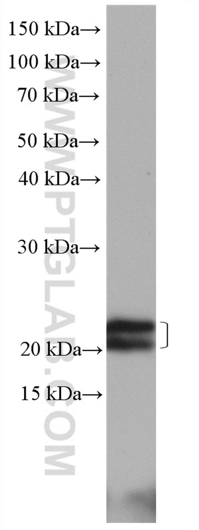 Caveolin-1 Antibody in Western Blot (WB)