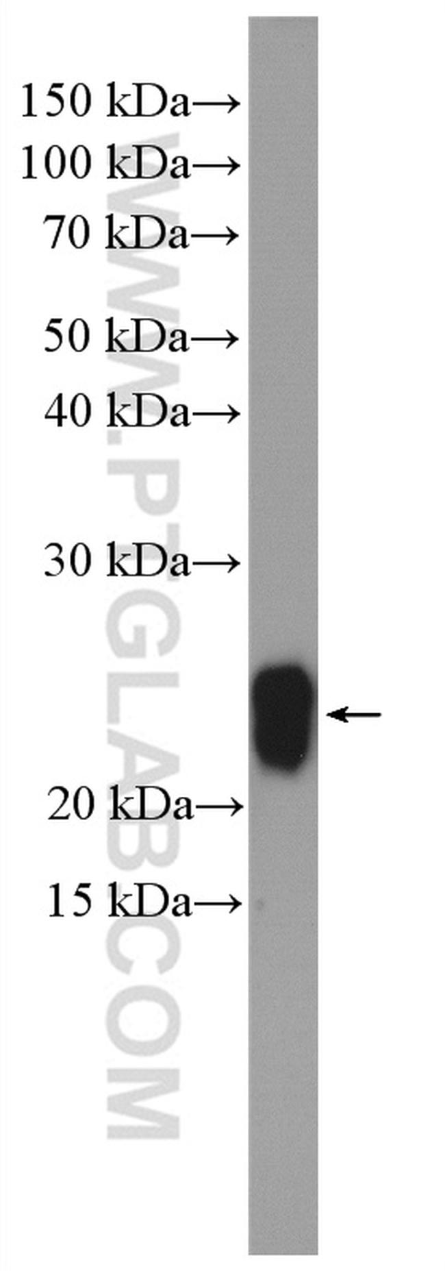 Caveolin-1 Antibody in Western Blot (WB)