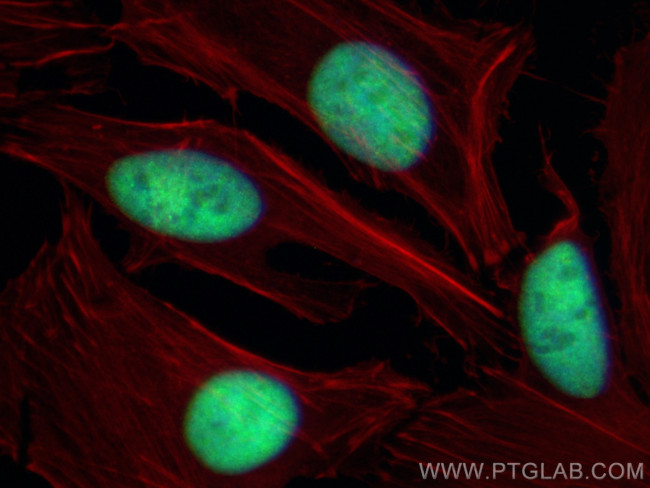 DEK Antibody in Immunocytochemistry (ICC/IF)