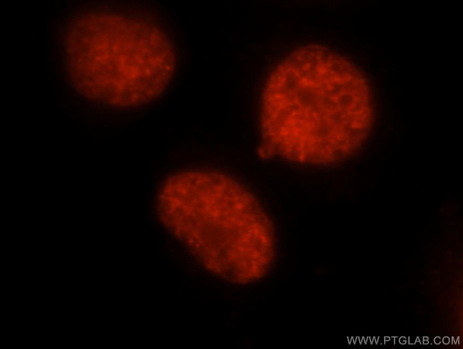 DEK Antibody in Immunocytochemistry (ICC/IF)