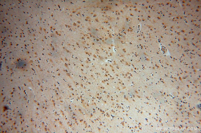 DEK Antibody in Immunohistochemistry (Paraffin) (IHC (P))