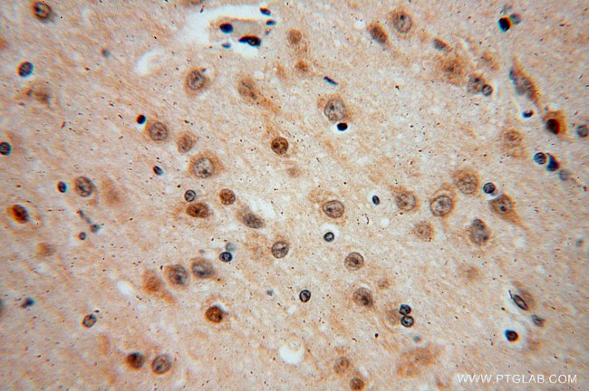 DEK Antibody in Immunohistochemistry (Paraffin) (IHC (P))