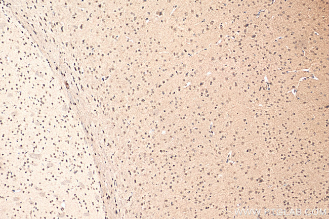 DEK Antibody in Immunohistochemistry (Paraffin) (IHC (P))