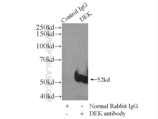 DEK Antibody in Immunoprecipitation (IP)