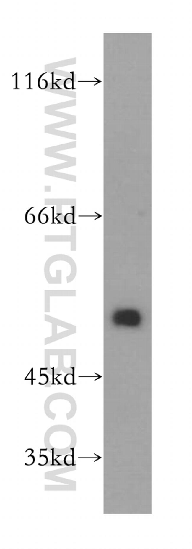 DEK Antibody in Western Blot (WB)