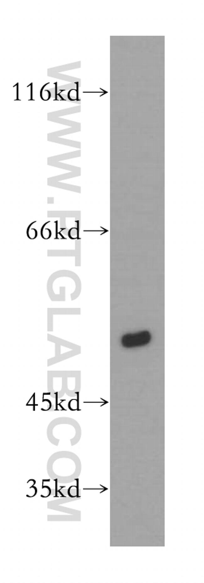 DEK Antibody in Western Blot (WB)