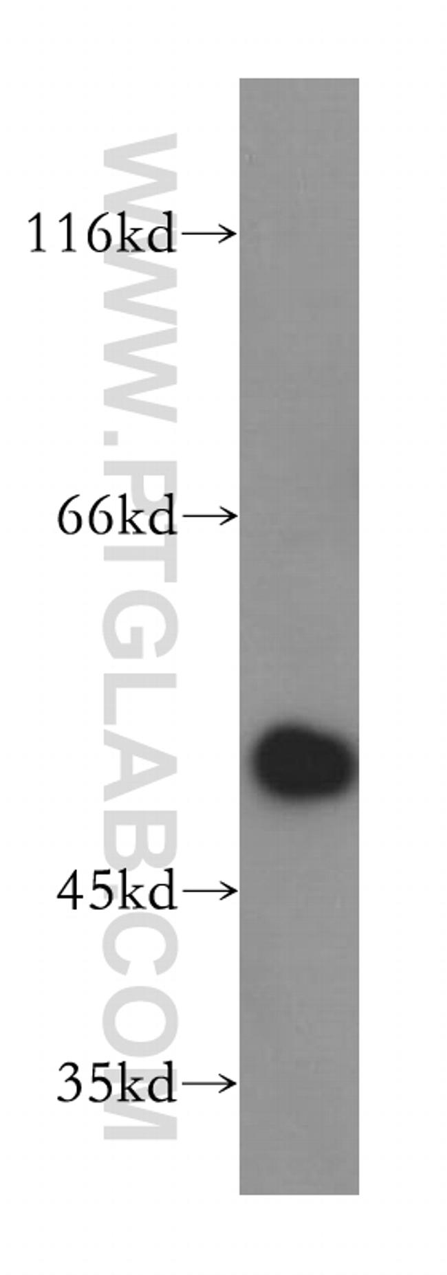 DEK Antibody in Western Blot (WB)