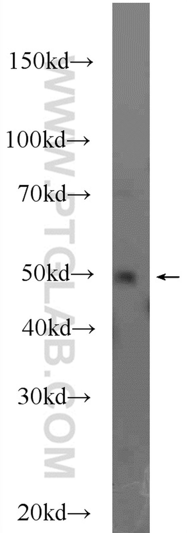 DEK Antibody in Western Blot (WB)