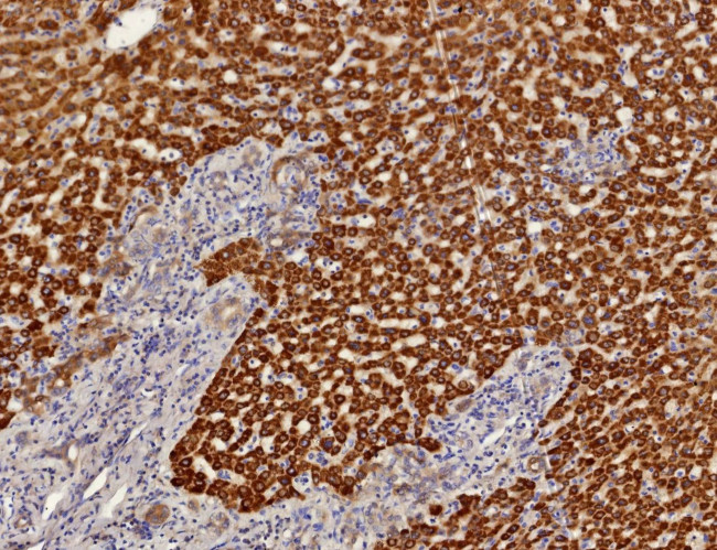 Aldo-keto Reductase Family 1 Member C1/DD1 Antibody in Immunohistochemistry (Paraffin) (IHC (P))