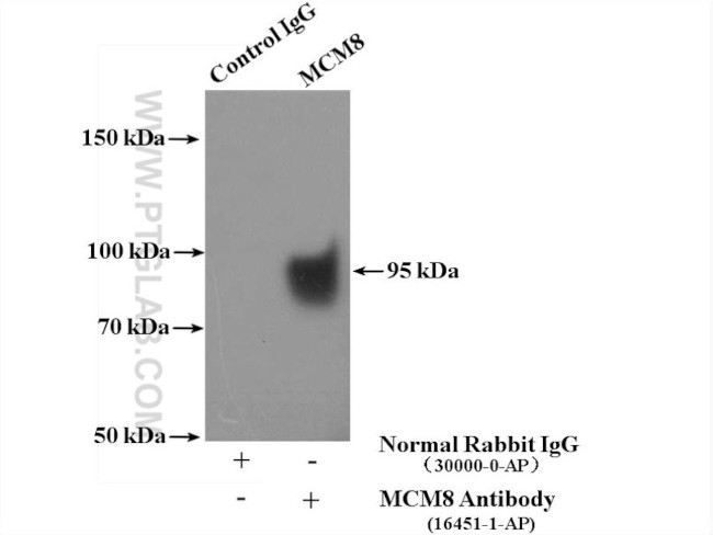 MCM8 Antibody in Immunoprecipitation (IP)