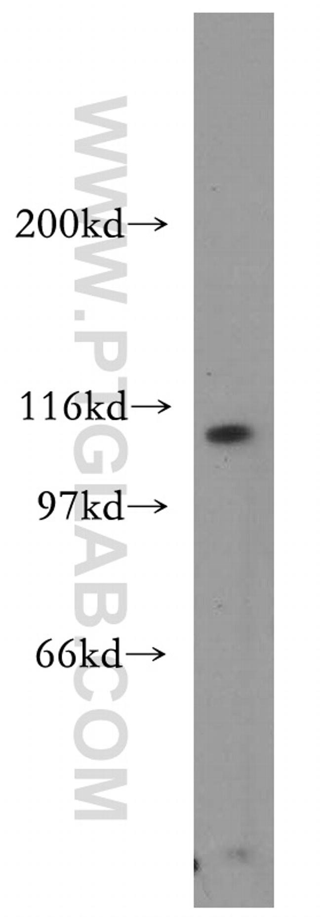 AP3D1 Antibody in Western Blot (WB)