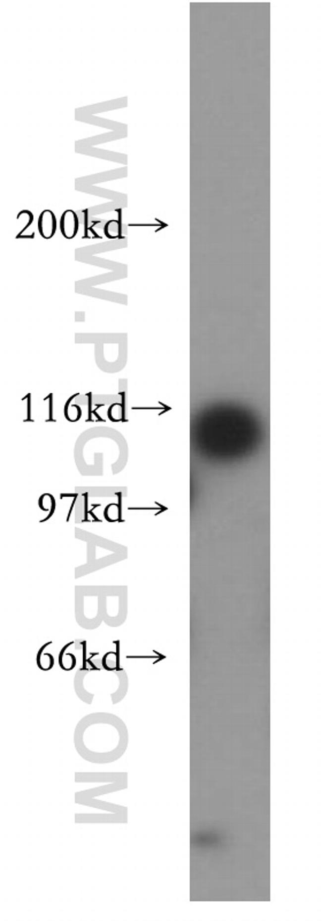 AP3D1 Antibody in Western Blot (WB)