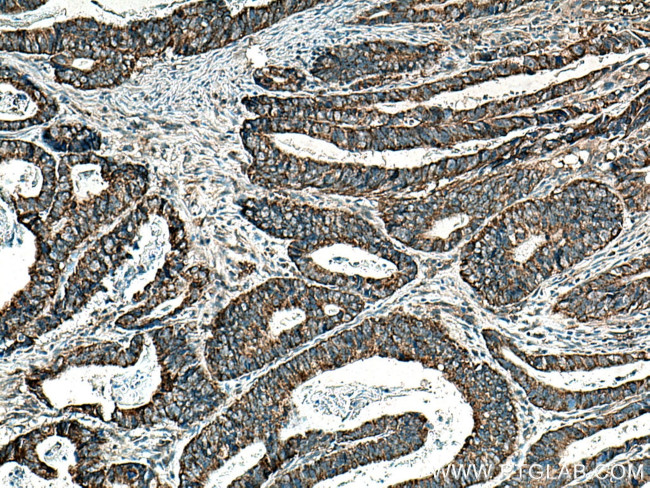 MRPS35 Antibody in Immunohistochemistry (Paraffin) (IHC (P))