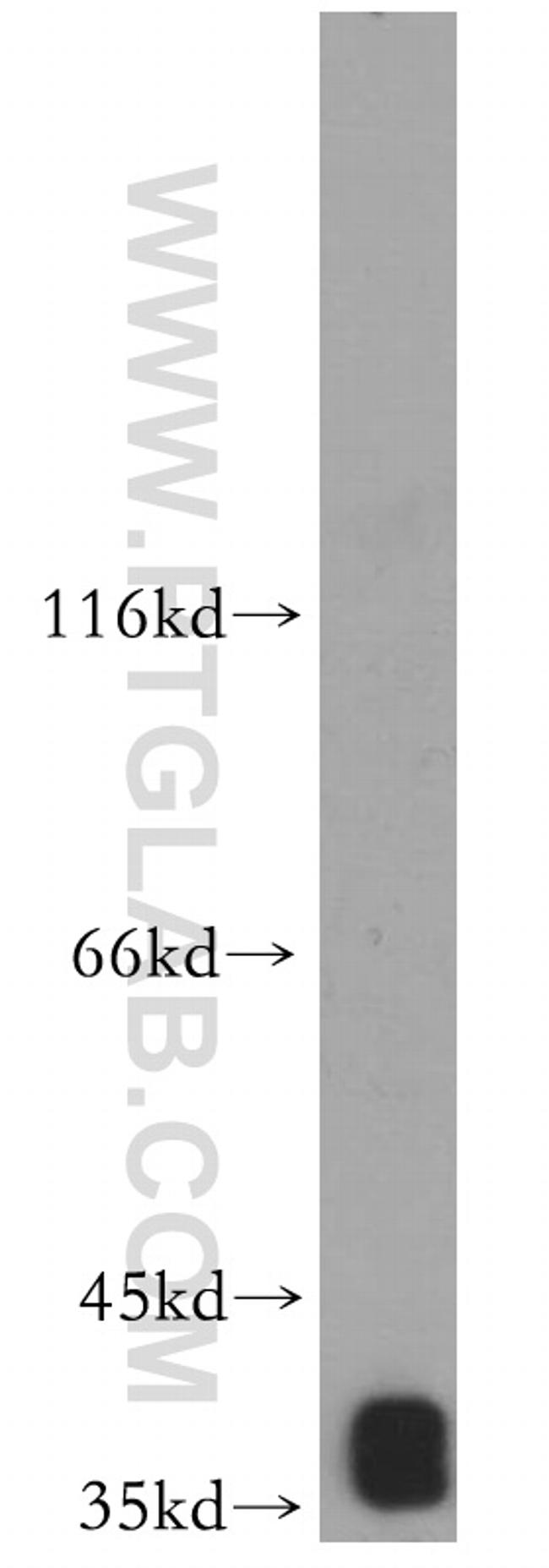 MRPS35 Antibody in Western Blot (WB)